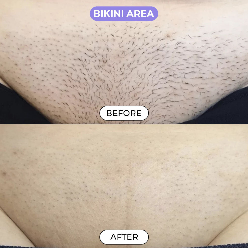 Luxira™ Hair Removal Cream