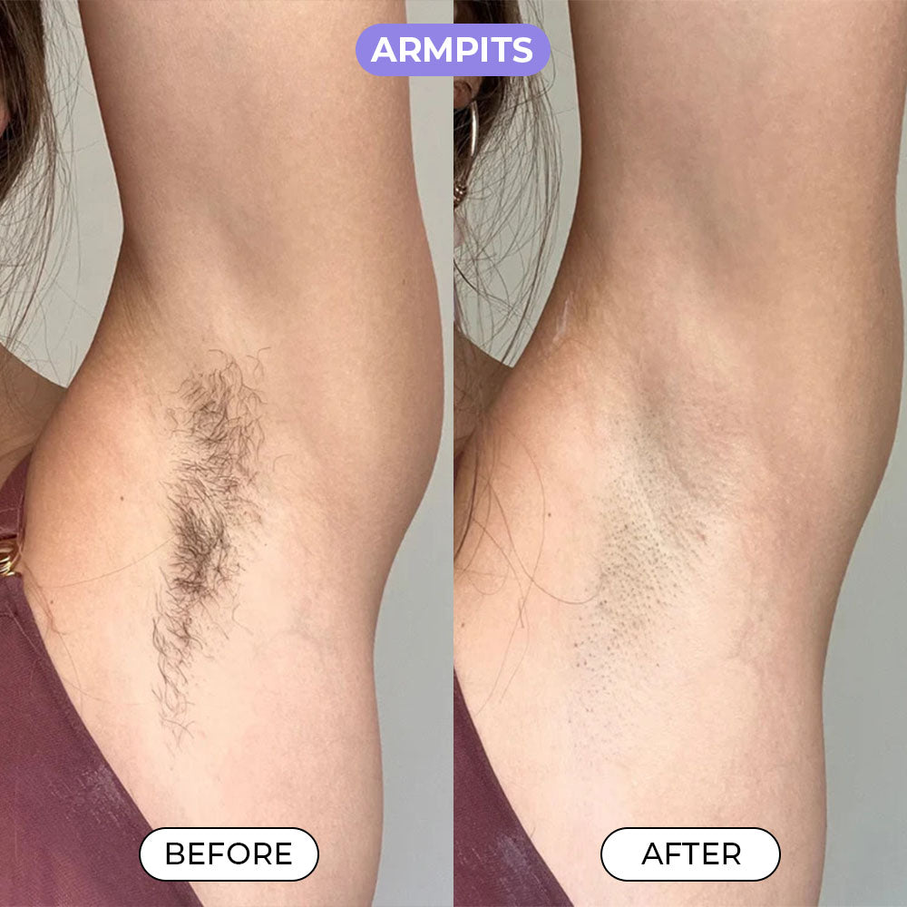 Luxira™ Hair Removal Cream