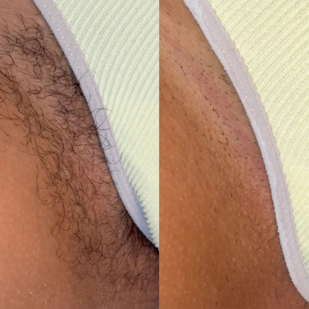 Luxira™ Hair Removal Cream