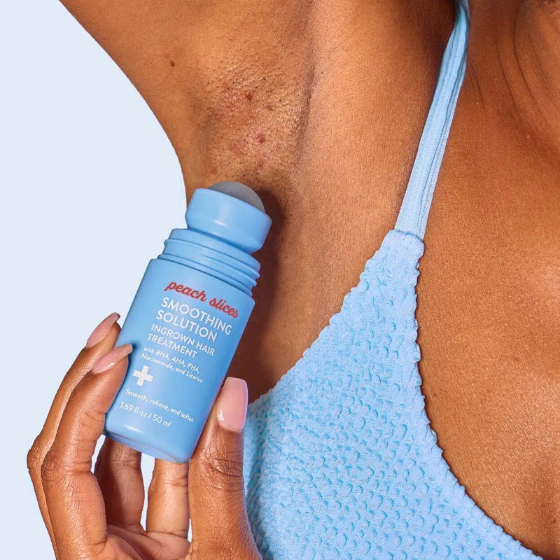SmoothGlo Ingrown Solution