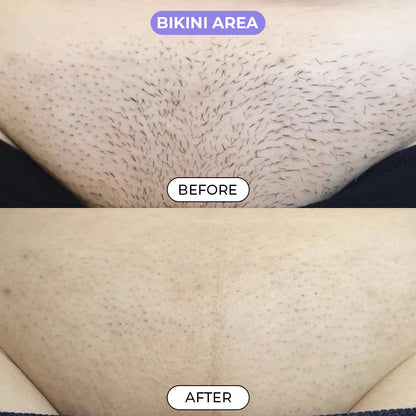 Luxira™ Hair Removal Cream