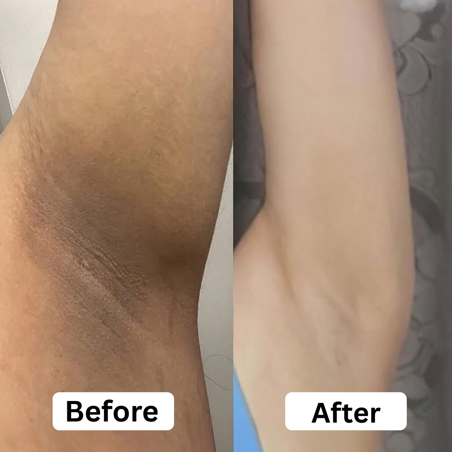 Armpit Turmeric Brightening Deodorant